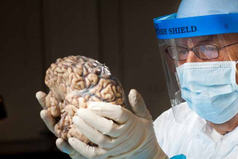 Интервью с молодым ученым о том, почему *нельзя есть  мозг* и что такое прионы