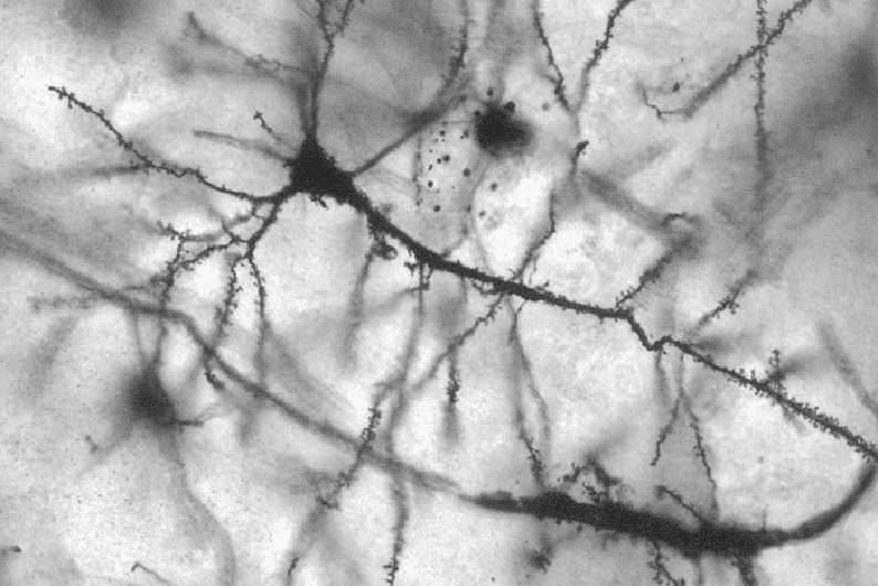 Замороженные словоформы: что изучает нейролингвистика и как наш мозг воспринимает языки